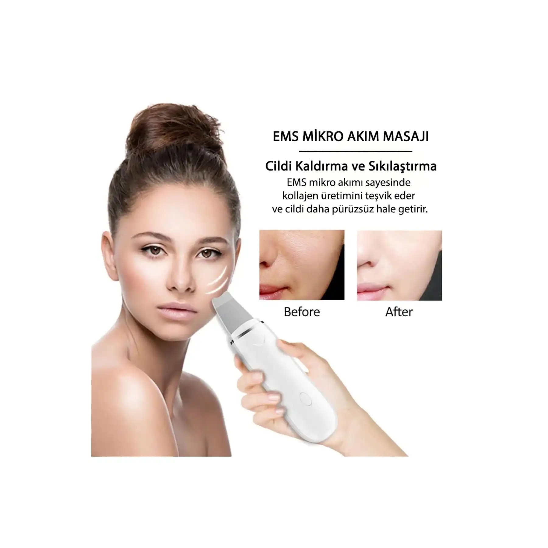 Ultrasonic Skin Scrubber Derma F - دستگاه اتو صورت درما اف و اسکین اسکرابر