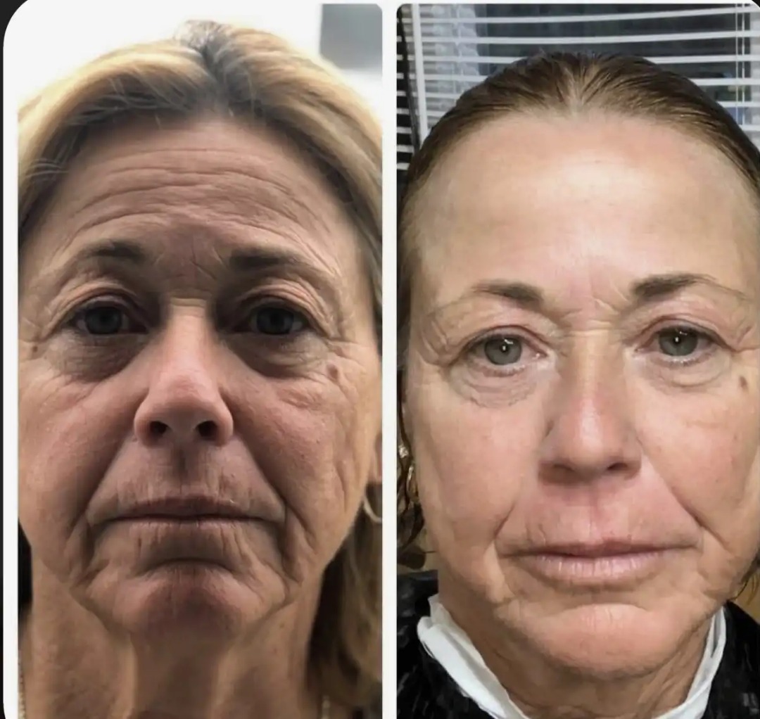 پک 4تیکه مراقبتی لوکس لامر
