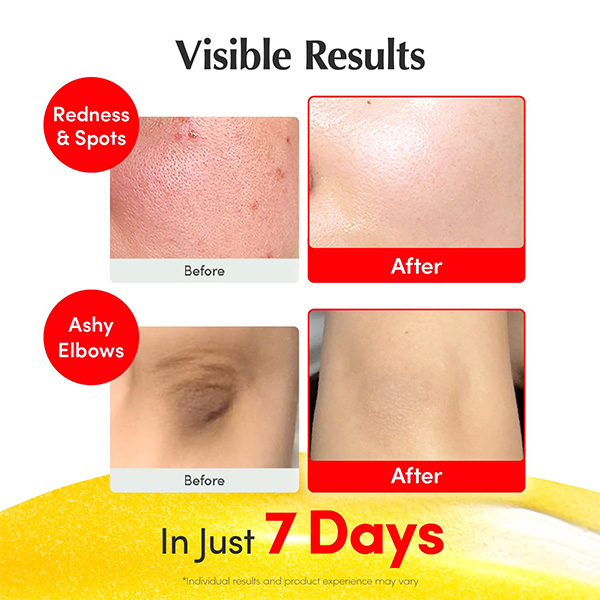 سرم ضد لک و روشن کننده اکوال بری Eqqual Berry Glow Filter Vitamin Illuminating Serum 30Ml
